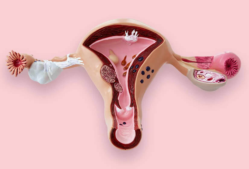 آیا عفونت مانع تخمک گذاری می شود؟