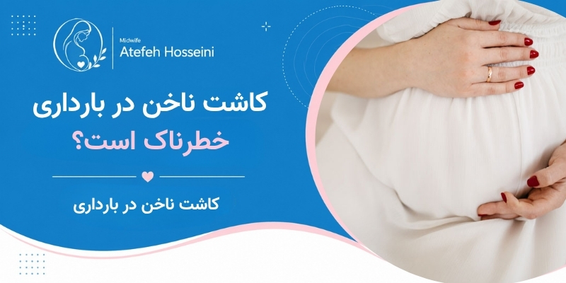 کاشت ناخن در بارداری