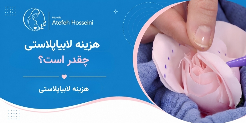 هزینه لابیاپلاستی چقدر است؟