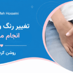 تغییر رنگ واژن چگونه انجام میشود؟